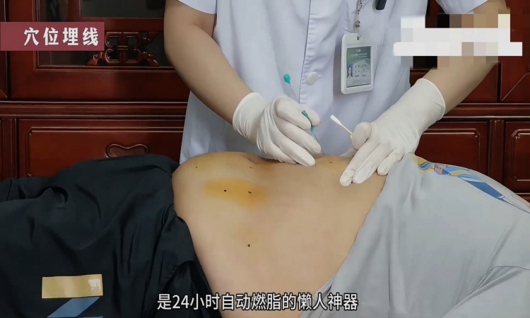 减肥计划总泡汤？ 中医解锁“躺瘦”黑科技